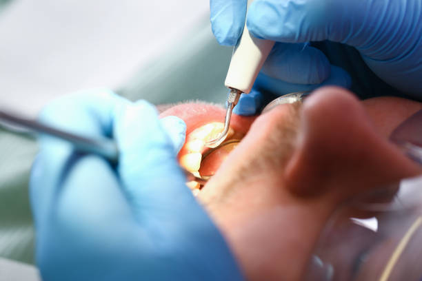 Best Emergency Treatment for Toothache in Walnut, IL