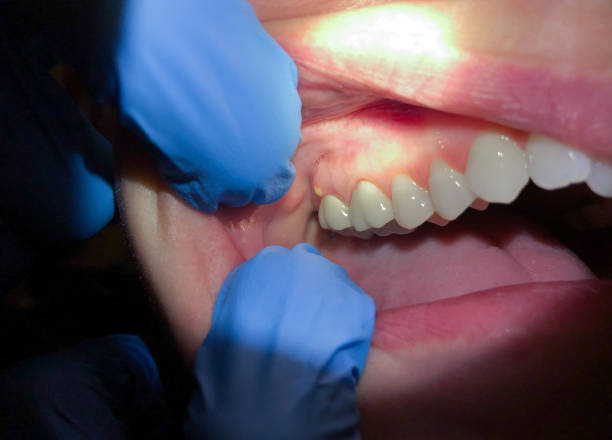Best Walk-In Emergency Dentist in Walnut, IL