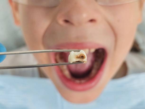 Best Emergency Dental Surgery in Walnut, IL